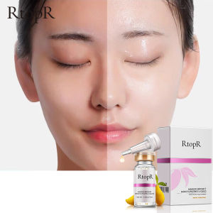 RtopR Face Whitening Anti Winkles Moisturizing Mango Serum Skin Care Anti-aging Liquid Facial Ance Treatment Remove Dark Spots Serum [LazChoice]