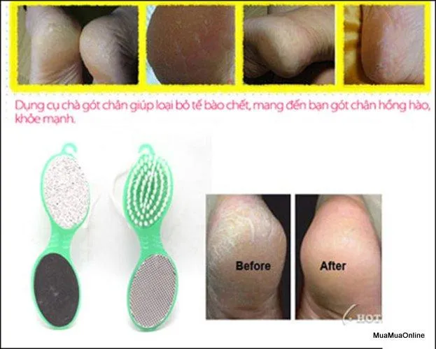 %C4%90%C3%A1%20B%E1%BB%8Dt%20Bi%E1%BB%83n%20Ch%C3%A0%20G%C3%B3t%20Ch%C3%A2n%204%20Trong%201%20Cao%20C%E1%BA%A5p%20-%20Image%204