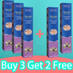 Wart remover ubat ketuat skin tag remover cream kutil removal ubat kutil tahi lalat ketuat dan biji kolesterol