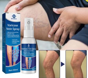 Xịt Loại Bỏ Tĩnh Mạch Giúp Cải Thiện Lưu Thông Máu Giảm Đau Tĩnh Mạch An Toàn 30ML