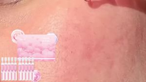 Pink One Day Serum 10 Vials Salmon Extract Hydrating Repair Essence for Firm Radiant Skin Gentle Korean Skincare Daily Care