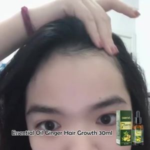 Okenys Hair Growth Spray hair Treatment Ginger Essential Anti Hair Loss Spray Hair Grower Serum