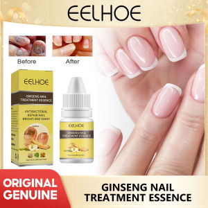 Eelhoe Ginseng Grey Nail Essence Thickening Nail Repairing Nutrition Shining Nail Softening Nourishing essence Nail Fungus Treatment Essence Ginseng Grey Nail Repair Serum Bright White Fungus Removal Gel Foot Toe Care