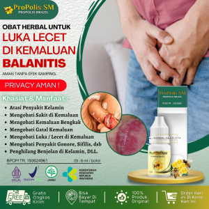 Obat Balanitis Oles Herbal Alami Obat Balanitis Pria Pengering Lecet di Kepala Penis Gatal Kemaluan Pria Gatal di Kepala Penis Obat Penis Bengkak & Sakit Kepala Penis Bengkak Kulup Penis Gatal Lecet Berdarah Bernanah Salep Balanitis Propolis SM