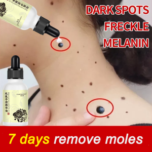 7 days Removes mole Rose Essential oil 20ml Lighten melanin remove moles skin care light spots spot removal freckle Brighten skin colour Vitamin e Serum