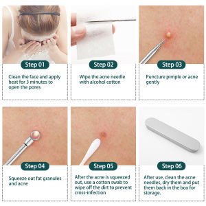 4PCS / 8PCS Blackhead Remover Kit Comedone Pimple Extractor Tool Acne Removal Kit Acne Needle Blemish Remover Set for Blackhead Whitehead Popping with Case