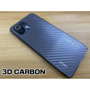 Oppo Reno 14 Pro 5G / 14 5G / Reno 13 pro / 13 / Reno 12 Pro 5G / 12 / Reno 11 / 11 pro / Reno 10 Pro / 10 / 10 Pro+ / Reno 6 5G / 6 Pro 5G / 6 Pro+ 5G / 6 Hydrogel Soft Screen Protector