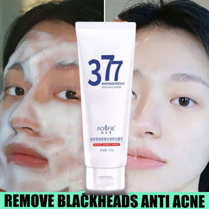 Whitening Face facial Freckle cleanser krim jeragat paling berkesan