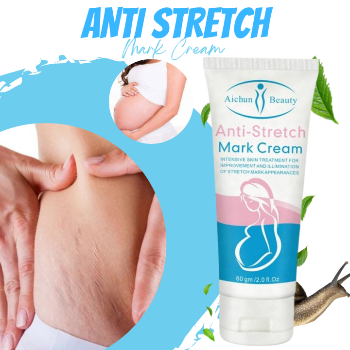 Original Anti-Stretch Mark Cream Intensive Skin Treatment for Improvement  and illimination of stretch mark appearances Moisturizing & Soothing Cream  Glutathione Intensive Skin Care - Lazada