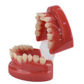 3D Resin Dental Model Teeth Malocclusion Model For Demostration Teaching Dental Students Study Oral Dentistry Products. 