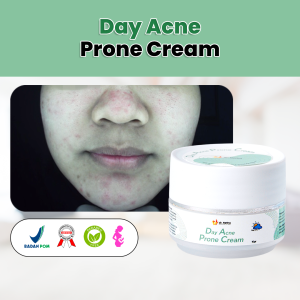 Cream Pelembab Wajah ACNE DAY CREAM SPF 30 BPOM - Krim Pelembab untuk Wajah Jerawat dan Berminyak