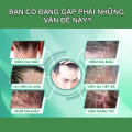 Dầu gội nấm da đầu dược liệu Tinea chống ngứa giảm gàu, rụng tóc và nấm ngứa da đầu - 100ml. 