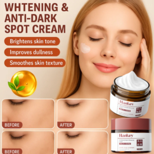 🌸Buy 1 Get 1 Free🌸 50g Whitening Freckle Cream Packed with Arbutin Whitening Cream Freckle Removal Cream Melanin Dark Spot Removal Cream Nourishing Moisturizing Brightening Skin