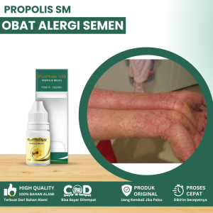 Obat Alergi Semen Obat Alergi Kena Semen Obat Gatal Kulit Alergi Semen Gatal Alergi Pada Kulit Ruam Di Kaki Kemerahan Obat Penghilang Gatal Alergi Semen Kulit Bintik Bintik Kecil Ruam Di Kaki Kemerahan Dengan Propolis SM