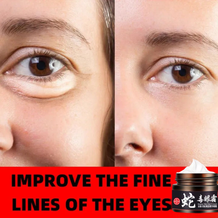 Cream Mata Panda Aging Eye Cream Remove Dark Circles Repair Puffiness/krim menghilang kan kantung mata- Krim Pemutih Kantung Mata - krim mata pencerah - cream untuk mata panda - Cream mata panda dan keriput - penghilang kantung mata kendur