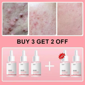 Peptide collagen serum Remove Acne Essence Enhances Skin Radiance Provides Deep Hydration Smooths Skin Texture Korean products2026