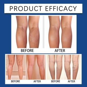 Compression Knit Knee Sleeve for Fitness Workout Tennis Knee Golfer Weight Lifting Knee Support Knee Protectors Sleeve