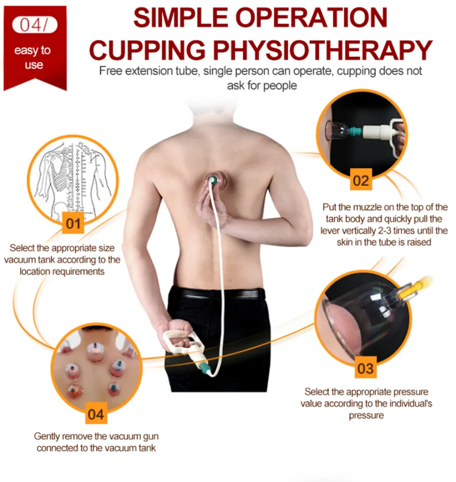 Coiry Vacuum Suction Cupping Family Body Therapy Vacuum Suction