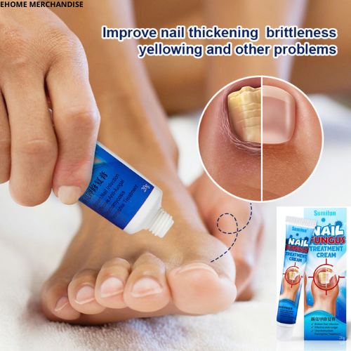 Effective Nail Fungus Treatment Cream Toe Nail Fungus Serum Anti-infection  Removal Paronychia Onychomycosis Repair Gel Foot Care - AliExpress