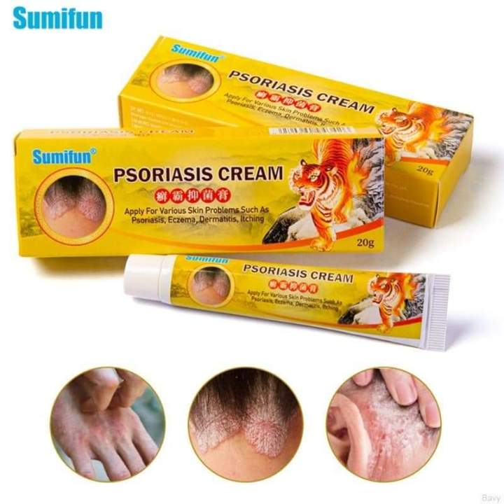 Original !! Sumifun Psoriasis Cream Bacteriostasis Eczema Dermatitis ...