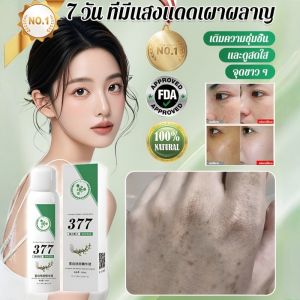 🔥ร้อนแรง🔥 377 สเปรย์ไวท์เทนนิ่ง สเปรย์ฉีดน้ำ 【เห็นผลใน 7 วัน】 น้ำมันเอสเซนส์ปรับผิวใส สเปรย์ออโรร่า วอเตอร์ สปอต ไลท์เทนนิ่ง