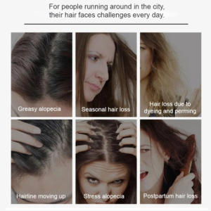 Ginger set smooth and moisturizing hair  Ginger Antihair Loss Shampoo Set Smooth Conditioner Ginger Shampoo AntiDandruff Antiitch Shampoo