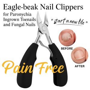 Angled Eagle Beak Nail Clippers Ingrown Nails Set Stainless Steel Rust Resistant Home Manicure Tools Say Goodbye To Ingrown Nails