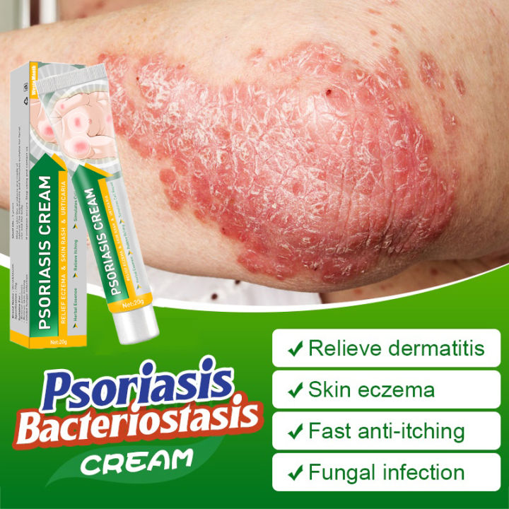 Antibacterial Ointment Gatal Ubat Original Remove Wart lower body Odor