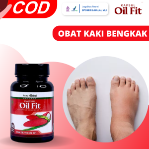Obat Kaki Bengkak Obat Kaki Bengkak Dan Nyeri Obat Kaki Bengkak Keseleo Kaki Bengkak Karena Asam Urat Edema Kaki Bengkak Pengempis Kaki Bengkak Obat Kaki Bengkak Karena Asam Urat Dengan OilFit