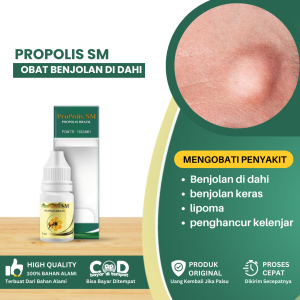 Obat Benjolan Di Dahi Minyak Oles Benjolan Di Jidat Benjolan Di Kepala Penghancur Benjolan Keras Benjolan Lipoma Tonjolan Keras Seperti Jerawat Obat Penghancur Kelenjar Di Jidat Obat Benjolan Uci Uci Benjolan Lunak Di Kepala Anak - Propolis SM