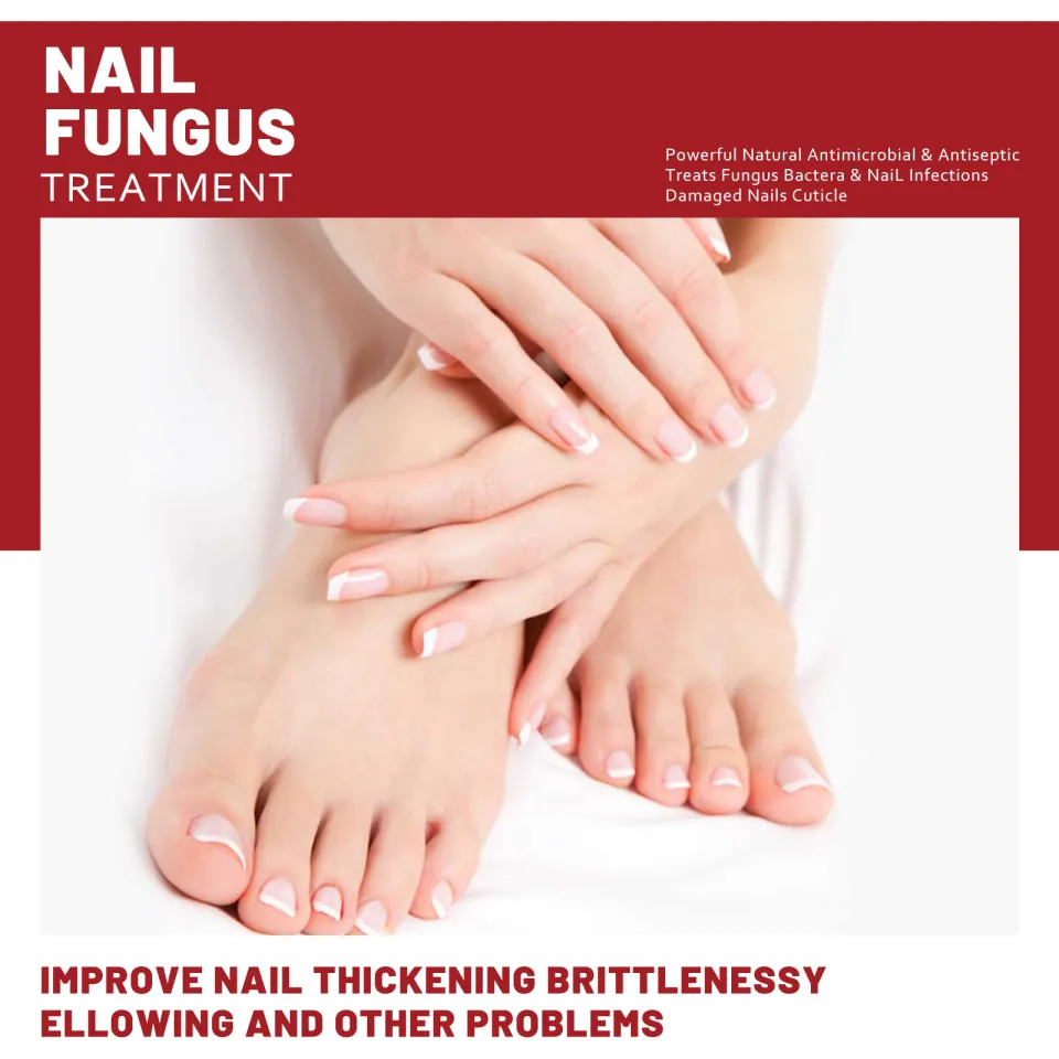 YUANHUILI Nail Fungus Treatment Whitening Toe Anti Infection Nail Care For  Healthy Feet And Hands Nails Essence (50ml) - Walmart.com