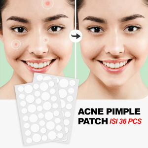 Acne Pimple Patch Obat Jerawat Masker Jerawat Isi 36pcs Penghilang Jerawat