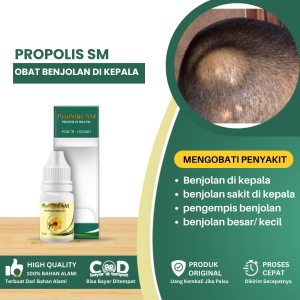 Obat Penghilang Benjolan Di Kepala Obat Herbal Benjolan Di Kepala Obat Benjolan Di Kepala Belakang Benjolan Sakit Benjolan Besar/ Kecil - Propolis SM