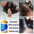 Anti dandruff shampoo，anti-itch shampoo，oil control shampoo 300ml Makes hair fresh, smooth, clean, sterilizes, and deeply cleans the scalp. It can be used by men, women, the elderly, and children.. 