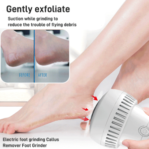 🌟Top Rated🔥 Electric Pedicure Machine Wireless Charging to Remove Dead Skin Automatic Foot Callus Rubbing Pedicure Pedicure Tool Pedicure Tool