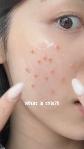 Tinh chất Centellian 24 Madeca Micro Startoc Serum 50ml