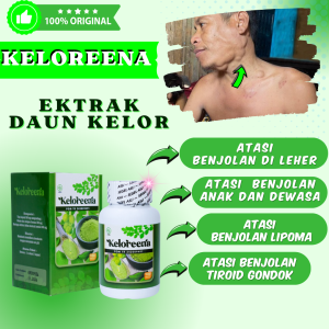Obat Benjolan Di Leher Penghilang Benjolan DiLeher Membengkak Pembengkakan Kelenjar Bening Tiroid Leher Lipoma Keloreena Original Daun Kelor Asli Kelorena