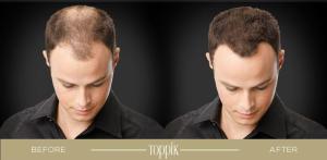 Toppik Hair Building Fiber 12G Black [New Stock 2025]