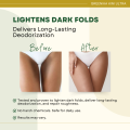 [ INGUINAL WHITENING DEODORANT ] Greenika Kini Ultra Deo + Whitening Roll-On for Bikini Area Deodorant for Women Whitening Original Inside Whitening Inner Thigh Whitening Cream Groin Women Beauty for You at 50% Off. 