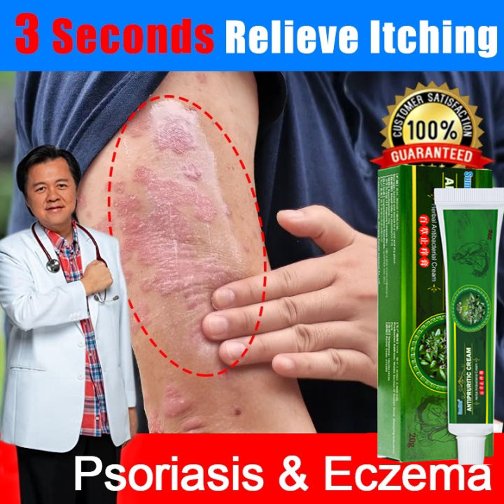 Antibacterial Psoriasis Ointment Eczema Cream For Skin Problem 20g