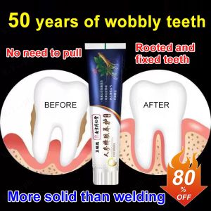 W 【1/2PCS】Stain removal whitening toothpaste Loose Teeth Care Toothpaste