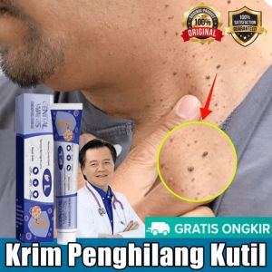 Warts Remover Pure Kasoy Cream Warts Remover Original Mole Remover Kulogo Buni Removal Warts Removal Pangtanggal Kulogo Buni An An Nunal Mole Milia Syringoma/Skin Care
