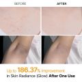 Dr.Melaxin Peel Shot Keratin Care Kojic Acid Turmeric Scrubs Spray 200ml | Korean Cosmetics. 