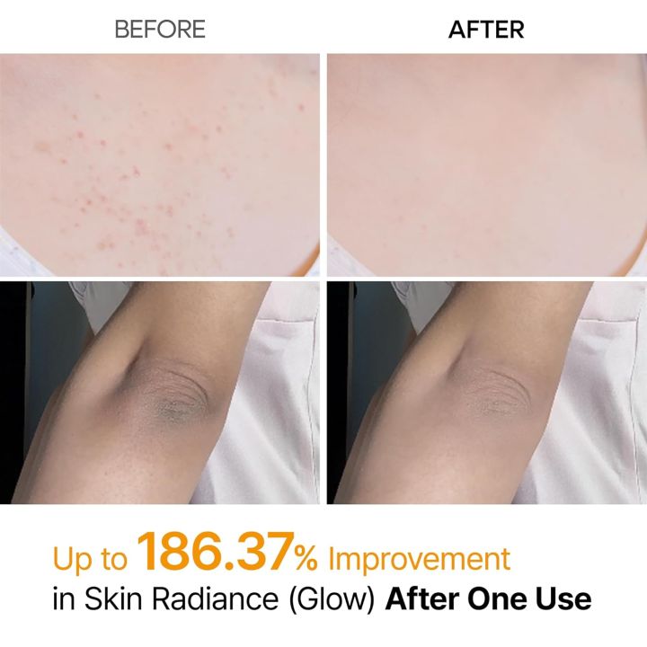 Dr.Melaxin%20Peel%20Shot%20Keratin%20Care%20Kojic%20Acid%20Turmeric%20Scrubs%20Spray%20200ml%20%7C%20Korean%20Cosmetics%20-%20Image%204
