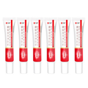 Freckle cream Fukken Whitening and Freckle-Removing Cream Niacinamide Moisturizing Face Cream Hydrating and Skin-Rejuvenating Care Spot-Removing and Blemish-Reducing Face Cream