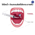 ส่งไว อุปกรณ์กำจัดนิ่วทอนซิล นิ่วทอมซิน สาเหตุกลิ่นปากเหม็นนิ่วทอลซิน ไซริ้งฉีดฟันคุด ลดกลิ่นปาก กลิ่นปากแรง ไซริ้งปลายโค้ง tonsil stone ไซริ้ง. 