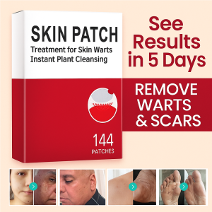 Cleanses Repairs And Smoothes Skin Lightens Corns And Grains Gentle Skin Care Patch For Warts