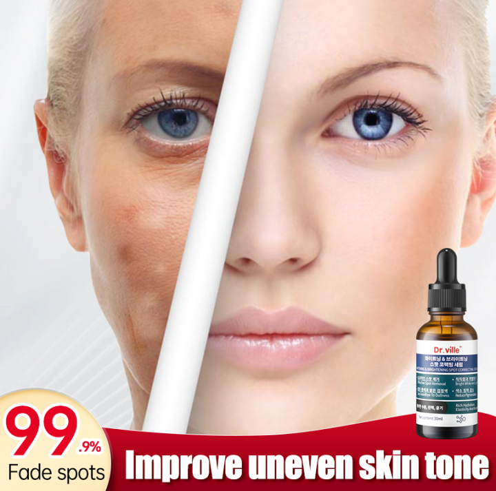 Korea Dark Spot Remover Serum Whitening Cream Face Freckles Remover
