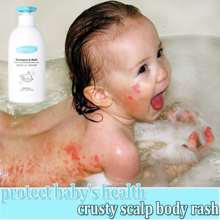 Baby Eczema body wash for baby Therapy Moisturizing Cream Itch