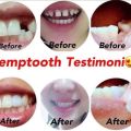 PROMO Temptooth temporary Tooth Buat Gigi Palsu Sendiri. 